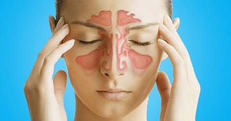 Грибковые поражения околоносовых пазух: растущая проблема